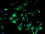 ICAM1 Antibody in Immunocytochemistry (ICC/IF)