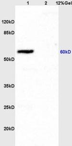 ICAM1 Antibody in Western Blot (WB)