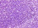 CD4 Antibody in Immunohistochemistry (Paraffin) (IHC (P))