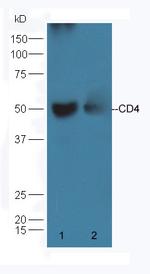 CD4 Antibody in Western Blot (WB)