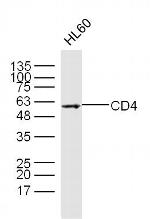 CD4 Antibody in Western Blot (WB)