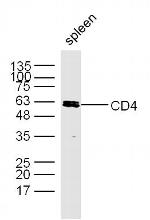 CD4 Antibody in Western Blot (WB)