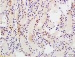 MRP1 Antibody in Immunohistochemistry (Paraffin) (IHC (P))