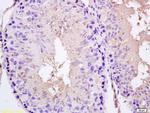 SPAG5 Antibody in Immunohistochemistry (Paraffin) (IHC (P))