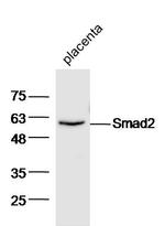 Smad2 Antibody in Western Blot (WB)