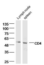 CD4 Antibody in Western Blot (WB)