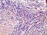 BRCA1 Antibody in Immunohistochemistry (Paraffin) (IHC (P))