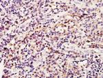 BRCA1 Antibody in Immunohistochemistry (Paraffin) (IHC (P))