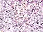 CD56 Antibody in Immunohistochemistry (Paraffin) (IHC (P))