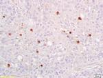 Phospho-NFKB p65 (Ser536) Antibody in Immunohistochemistry (Paraffin) (IHC (P))