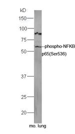 Phospho-NFKB p65 (Ser536) Antibody in Western Blot (WB)