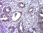 HPV16 E6 protein Antibody in Immunohistochemistry (Paraffin) (IHC (P))