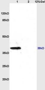 CXCR4 Antibody in Western Blot (WB)