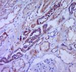 CSF3 Antibody in Immunohistochemistry (Paraffin) (IHC (P))