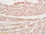 MYPN Antibody in Immunohistochemistry (Paraffin) (IHC (P))