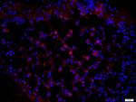 Pan Cytokeratin/p-CK Antibody in Immunohistochemistry (Paraffin) (IHC (P))