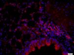 Pan Cytokeratin/p-CK Antibody in Immunohistochemistry (Paraffin) (IHC (P))