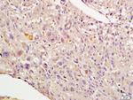 Nrf2 Antibody in Immunohistochemistry (Paraffin) (IHC (P))