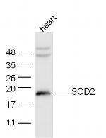 SOD2 Antibody in Western Blot (WB)