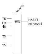 NADPH oxidase 4 Antibody in Western Blot (WB)