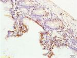 CK8 Antibody in Immunohistochemistry (Paraffin) (IHC (P))