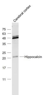 Hippocalcin Antibody in Western Blot (WB)