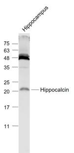 Hippocalcin Antibody in Western Blot (WB)