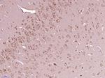 SRC Antibody in Immunohistochemistry (Paraffin) (IHC (P))