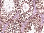 SRC Antibody in Immunohistochemistry (Paraffin) (IHC (P))