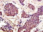 STAT5 Antibody in Immunohistochemistry (Paraffin) (IHC (P))