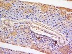 STAT5 Antibody in Immunohistochemistry (Paraffin) (IHC (P))