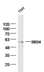 BBS4 Antibody in Western Blot (WB)