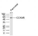 CCKAR Antibody in Western Blot (WB)