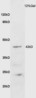 GALR2 Antibody in Western Blot (WB)