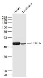 UBXD2 Antibody in Western Blot (WB)