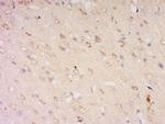 CLN8 Antibody in Immunohistochemistry (Paraffin) (IHC (P))