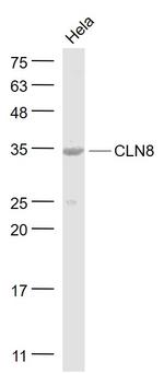 CLN8 Antibody in Western Blot (WB)