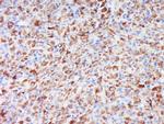 WRB/CHD5 Antibody in Immunohistochemistry (Paraffin) (IHC (P))