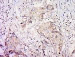 PAR-2 Antibody in Immunohistochemistry (Paraffin) (IHC (P))