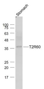 T2R60 Antibody in Western Blot (WB)