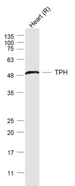 Tryptophan 5-hydroxylase 1, Tryptophan 5-hydroxylase 2 Antibody in Western Blot (WB)