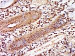 ZNF740 Antibody in Immunohistochemistry (Paraffin) (IHC (P))