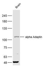 alpha2 Adaptin Antibody in Western Blot (WB)