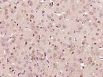 PKC iota Antibody in Immunohistochemistry (Paraffin) (IHC (P))