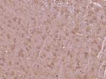 VPS13D Antibody in Immunohistochemistry (Paraffin) (IHC (P))