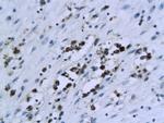 XIAP/BIRC4 Antibody in Immunohistochemistry (Paraffin) (IHC (P))