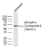 Phospho-Cytokeratin 8 (Ser431) Antibody in Western Blot (WB)