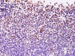 EXOSC10/PMSCL2 Antibody in Immunohistochemistry (Paraffin) (IHC (P))