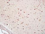 FAM134B Antibody in Immunohistochemistry (Paraffin) (IHC (P))