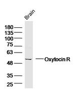 Oxytocin R Antibody in Western Blot (WB)